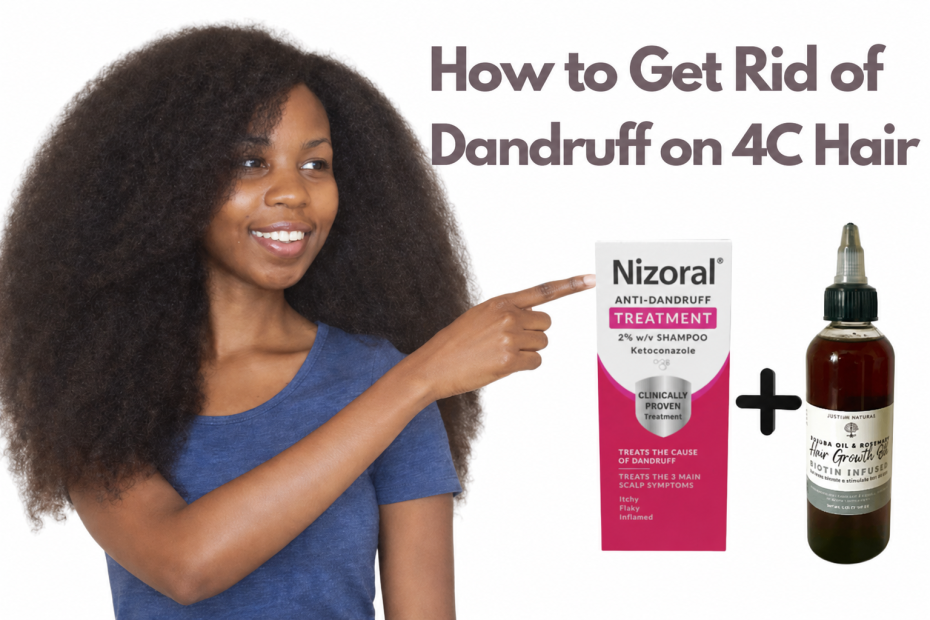 how to get rid of dandruff on 4c hair